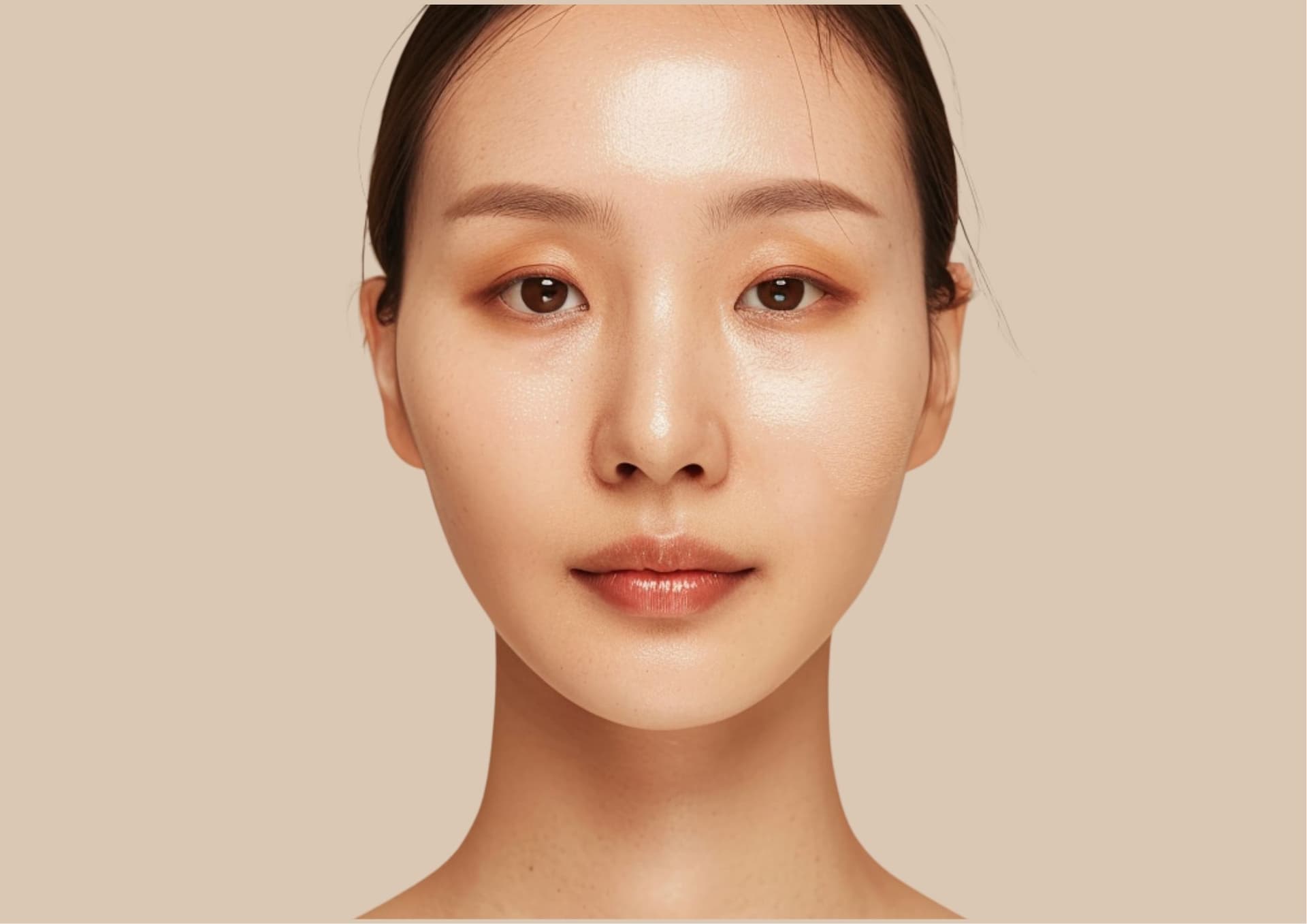 Facial balancing with fillers at Smile Well Coquitlam