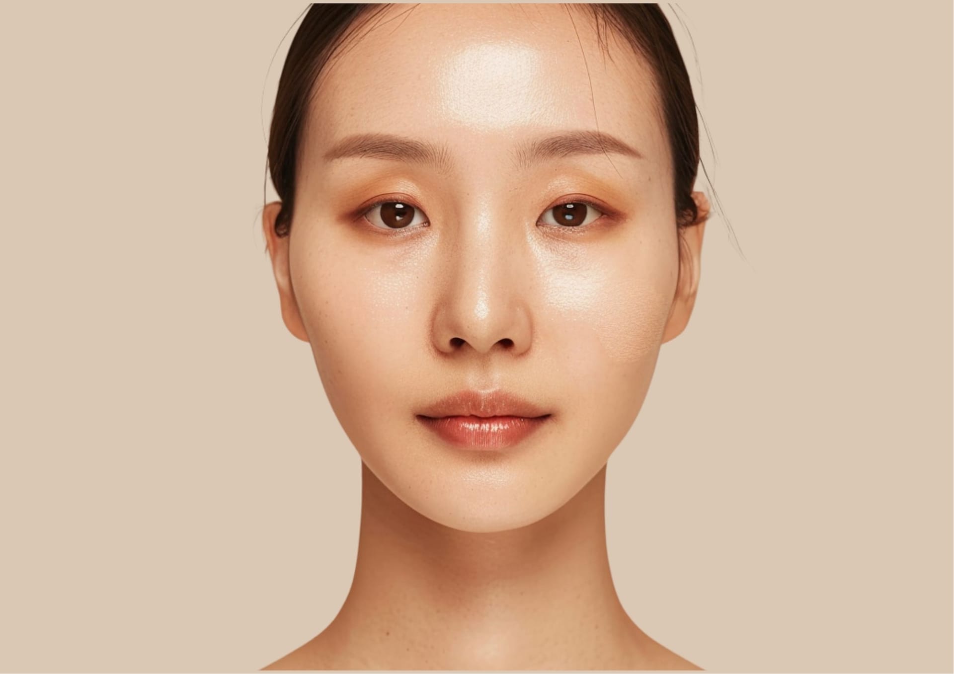 Facial balancing with fillers at Smile Well Coquitlam